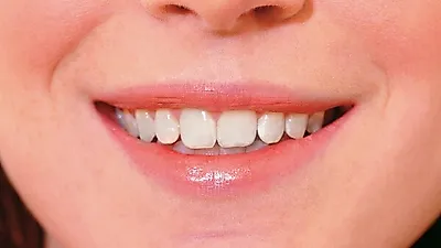 [미용정보] 누런이 어떻게 생기나 했더니… 치아미백 도전하기 앞서  '이것' 알아두자