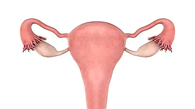 불규칙한 생리의 원인, 다낭성 난소증후군을 알아보자