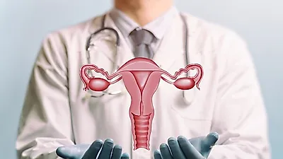 불규칙한 생리와 골반통이 따른다면? '난소암' 의심해야…수술로 정확한 진단 필요