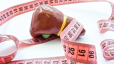 온몸이 피로한  지방간,  치료법은 '이것'?…  건강한 식생활로 바꾸자