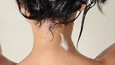 "고개 숙이기 부끄러워요" 스트레스 받는 정수리 탈모, 샴푸 사용과 두피 관리가 관건