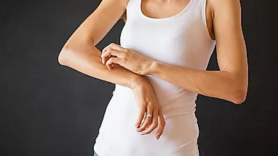 "밤마다 가려워 죽겠어요" 옴 증상, 전염성 매우 강해…치료할 수 있을까?