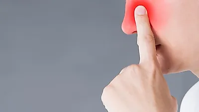 부비동염의 다른 말 '축농증', 부비동염 증상 및 치료 방법은?