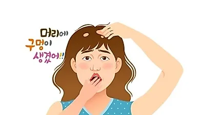 지루성두피 관리의 핵심은…'라이트'한 헤어 제품을 선택하라