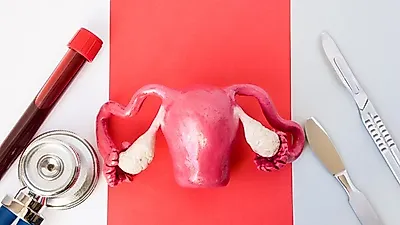 계속되는 생리통과 골반통, '자궁내막증' 때문이다?…자가진단으로 증상 확인해야