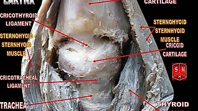 갑상선 항진증 그레이브스병, 그 증상은?