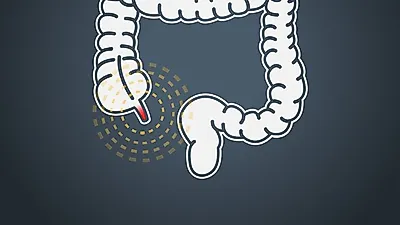 초기증상 발견했다면 바로 병원으로…,  심해지면   패혈증 생길 수 있어