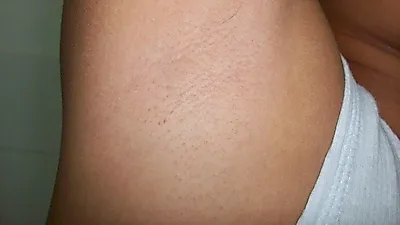 시도 때도 없이 터지는 겨드랑이땀, '데오드란트'로 해결 한다