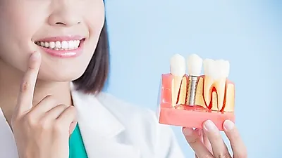 '치과치료 필요헌데 너무 비싼데'  고가의 치과치료  임플란트 VS 틀니 차이점이 뭐야?... 비용 외에 틀니와 임플란트 특징은?