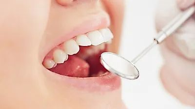 감당하기 힘든 치과비용   '치아보험'으로 걱정덜 수 있어…가입조건 및 가입방법은?