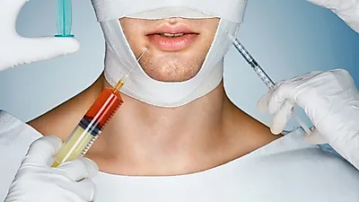 코 재수술, 2차 수술로 성공하려면 이전 수술 복기해봐야