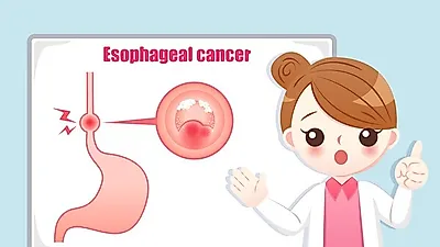 체한 것 같은 느낌  과 연속해서 나오는 트름이 있다면  '역류성식도염'의 위험에 처했을 수 있다... '역류성식도염'의 증상과  '역류성식도염 진단' X '역류성식도염'치료 Tip?