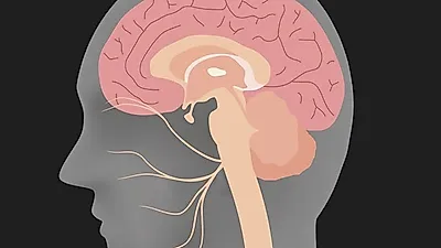 잔인한 병 치매,  치매의 원인과 증상 및  뇌에 좋은 음식까지