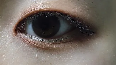 [건강] 황달증상, 주의 필요!…주요 증상은?