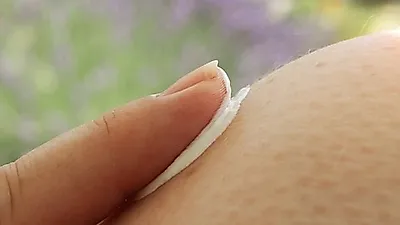 홈케어  튼살 지우기,  물 마시는 습관 중요해…비타민C 많은 음식까지