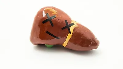 [간에 좋은 음식] 지방간 증상 '없다'! 지방간 치료에 좋은 모링가열매·모링가 효능과 부작용은?