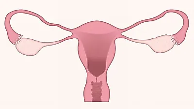 다낭성 난소 증후군 알 수 있는 초기증상은?..생활 습관 개선 중요