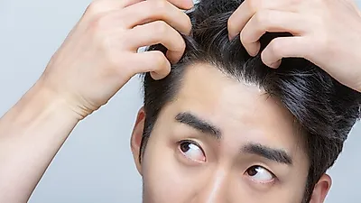 두피열 어떻게 내리는지 알면  예방 가능해…  탈모에 좋은 음식  두부와 미역  같이 권장하는 까닭은?