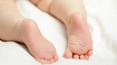 [육아건강]   올해 급증한   '수족구병', 증상은?…"손·발·입에 수포성 물집"