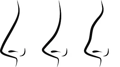 비염과 두통 유발하는 '비중격만곡증' 수술만이 해답, 비중격만곡증 증상은?