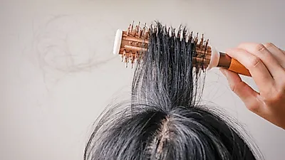 두피열 내리는 법만 알아도 탈모 예방 손쉬워