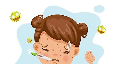 홍역 초기증상 감기와 비슷! 구분하는 방법은? 성인 홍역 예방접종 안 받은 사람多 전염성 높아 예방주사 권장