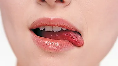건조하고 갈라지는 혀…혀로 내 건강상태를 알 수 있다?  혀갈라짐 원인 및 치료법