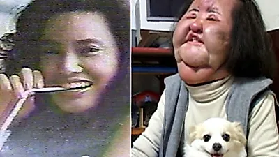 선풍기 아줌마 근황, '한미옥→한혜경'…과거 일본 가수 시절 아름다운 미모 불법시술 잘못된 선택