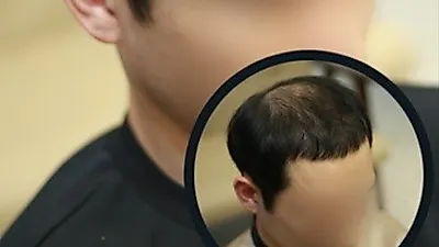 이음머리공작소, 남자맞춤가발 1+1 이벤트 진행