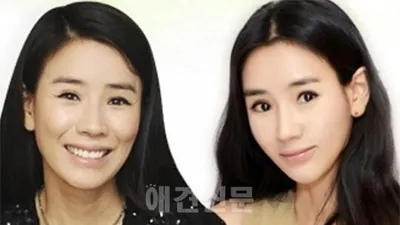 비디오스타 윤현숙, 양악 수술 후 미모 '눈길'..."턱관절 고통에서 벗어나 만족해"