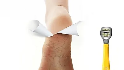 발각질, 굳은살 제거 위한 독일 풋케어 괴솔 '12월 특별기획' 선보여