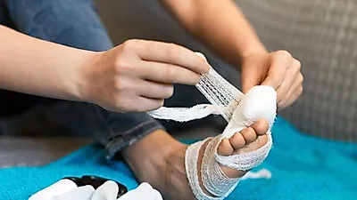 혹시 조갑박리증? 발톱 빠졌을 때 병원 가기 전 응급처치법 TIP