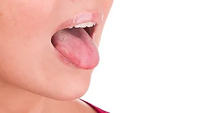극심한 통증 '구내염', 원인이 도대체 뭘까?…구내염 빨리 낫는 법은?