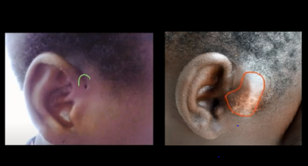 Doctor O'Donovan 유튜브 캡처 