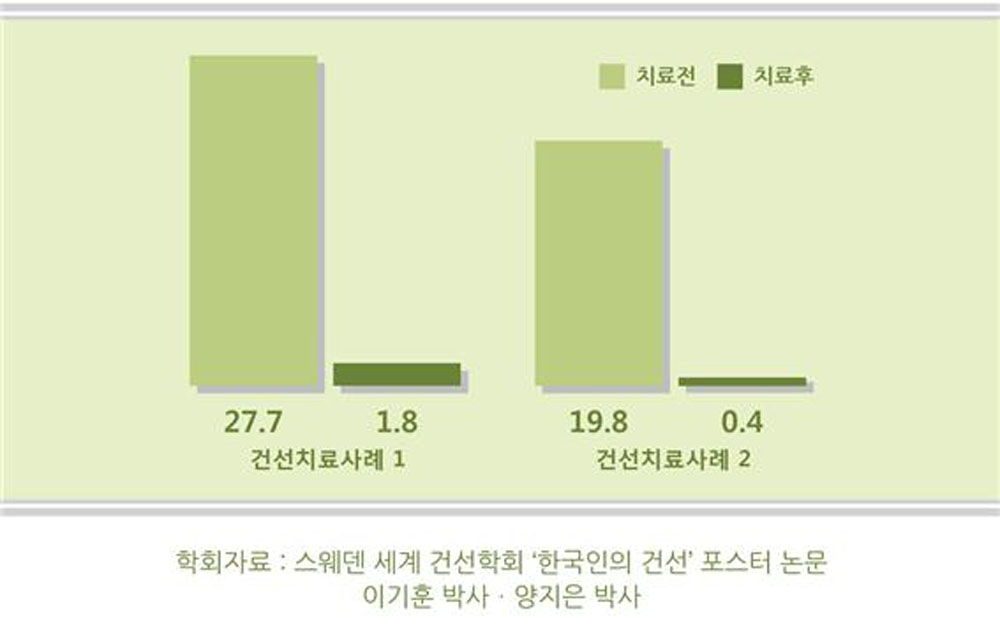 편도염, 감기는 피부 건선 발생의 주요 계기, 특히 젊은 층 주의해야