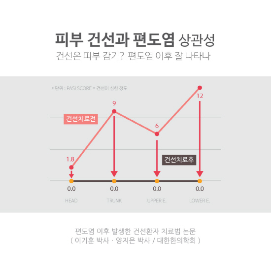 건선은 피부 감기? 편도염 이후 잘 나타나