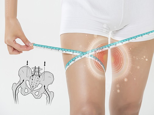 허벅지 안쪽 땀 차는 하체비만, 다이어트만 해서 가능할까?