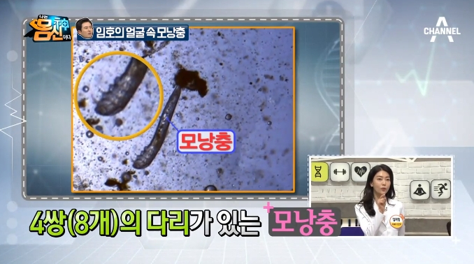 '나는 몸신이다 양배추팩' 초간단 모낭충 팩 만드는 방법은?