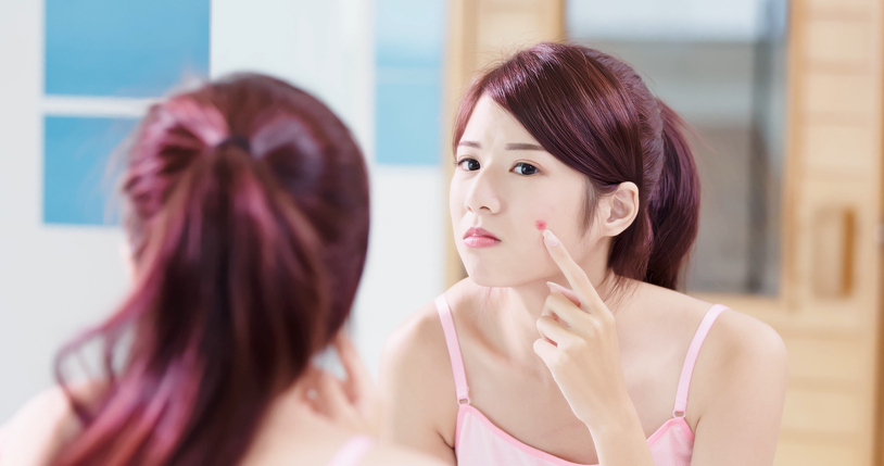 좁쌀 여드름이라고도 불리는 화이트 헤드, 원인과 제거 및 '화이트헤드 없애는 법'