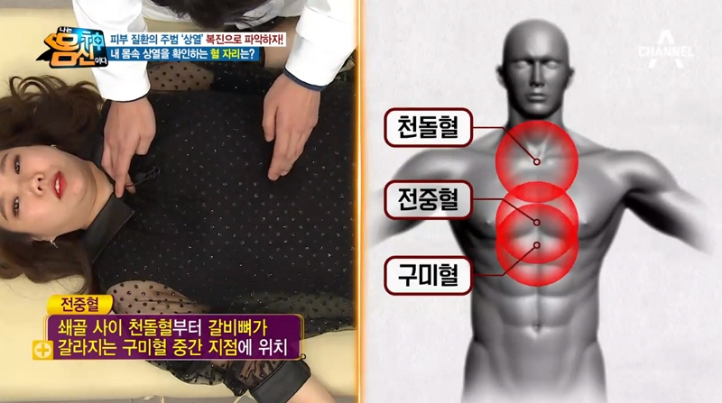 '나는몸신이다' 김도균, '콜린성두드러기+지루피부염+성인여드름' 원인은 상열? 얼굴열 내리는 팩으로 다스리기