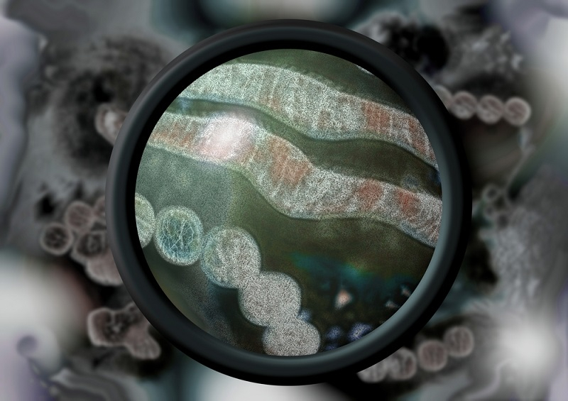 사람에게 전염되는 조류 독감 유형