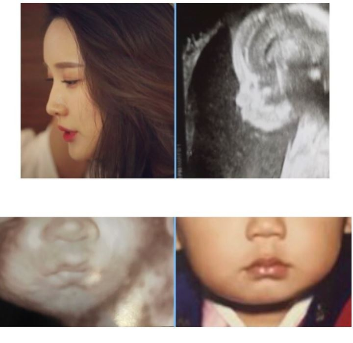 이현승 기상캐스터에서 한 아이의 엄마 준비 "초음파 사진 공개" 남편 최현상과 연일 실검 올라