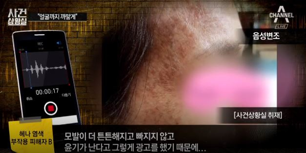 40대‧50대 중장년 여성 주로 피해 '충격' 헤나염색 부작용, 천연 원료라 믿었더니 얼굴 전체가