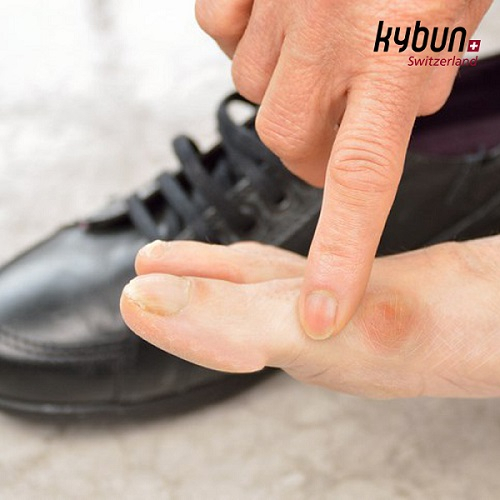 기분코리아 기능성신발 추천, "발가락 통증을 유발하는 무지외반증, 이제 기분(kybun)신발로 벗어나자!"