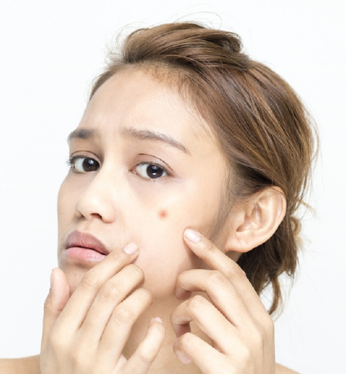 [피부 홈 케어 tip] 여드름 흉터 없애는 법부터 기미 없애는 방법, 등드름 없애는 법까지 꿀팁 모음