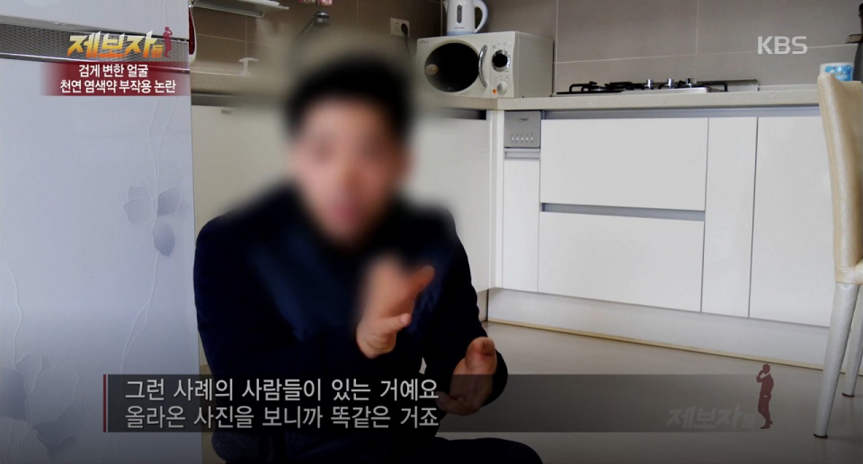 심각한 상처 남긴 '헤나염색 부작용', 공포의 검은 색소로 고통 받는 피해자들