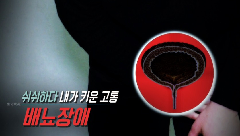 성인용기저귀까지..요실금, 전립선암, 간질성 방광염 등 원인인 배뇨장애, 일상생활도 불가능할 정도?