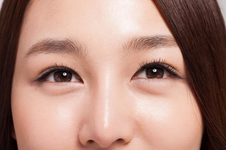 안검하수, 눈매교정을 이용한 쌍꺼풀 수술로 해결?...원인 및 증상은 어떨까
