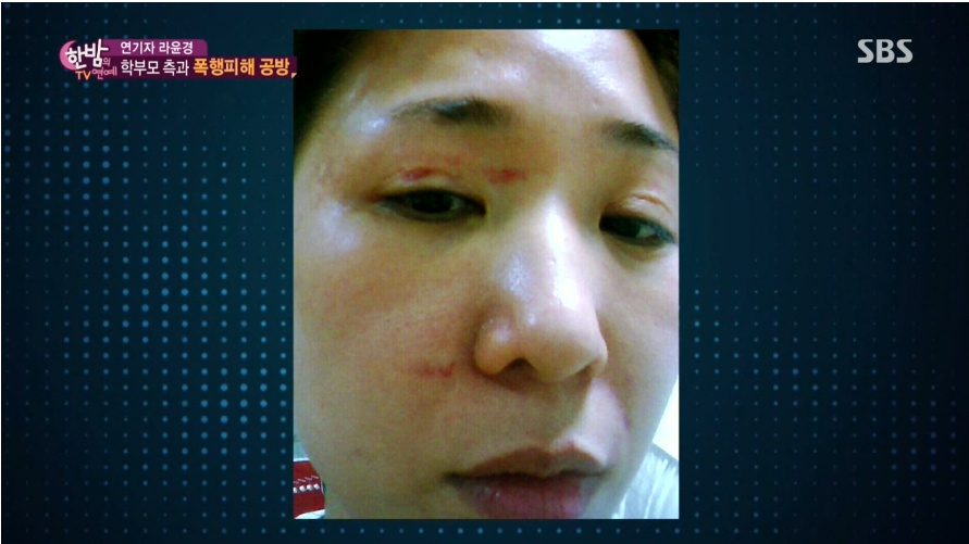 라윤경 폭행 사진에 '깜짝' 아들 수찬 있는데도 머리잡고 목 가격, 초등학생 입에서 '외롭다'.. 왜?