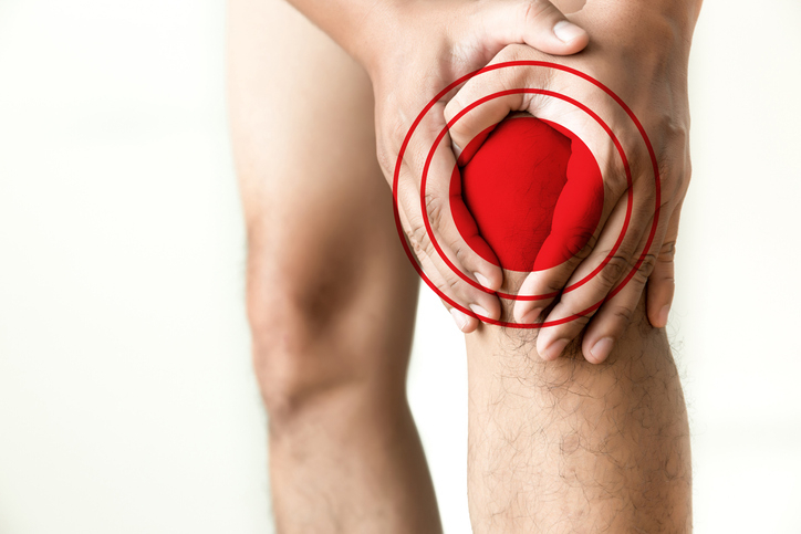 [관절에 좋은 음식] 관절영양제 슈퍼푸드 '보스웰리아(유향)' 효능과 부작용, 복용법은?